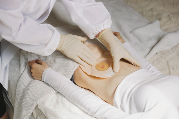 El TSJ de Cantabria reconoce la incapacidad permanente absoluta a persona que utiliza bolsa de urostomía
