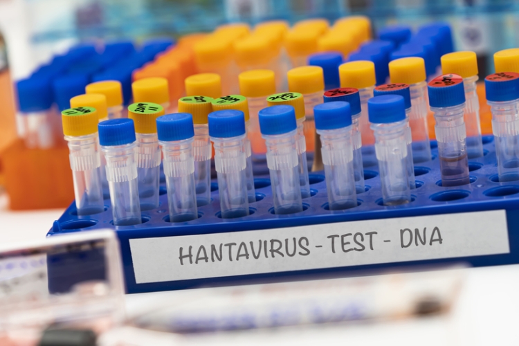 Criterio del INSS tratando el aislamiento preventivo por hantavirus como IT derivada de enfermedad común
