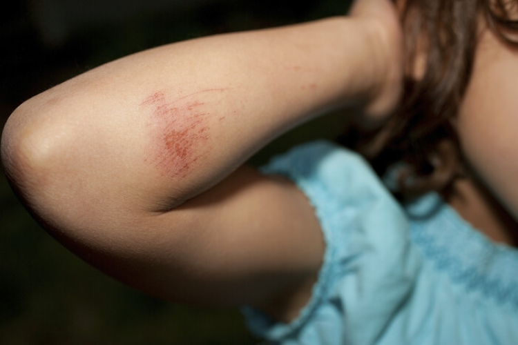 Evolución del tratamiento penal de la violencia vicaria